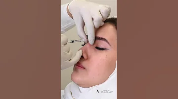 كيف صغرنا حجم الأنف 