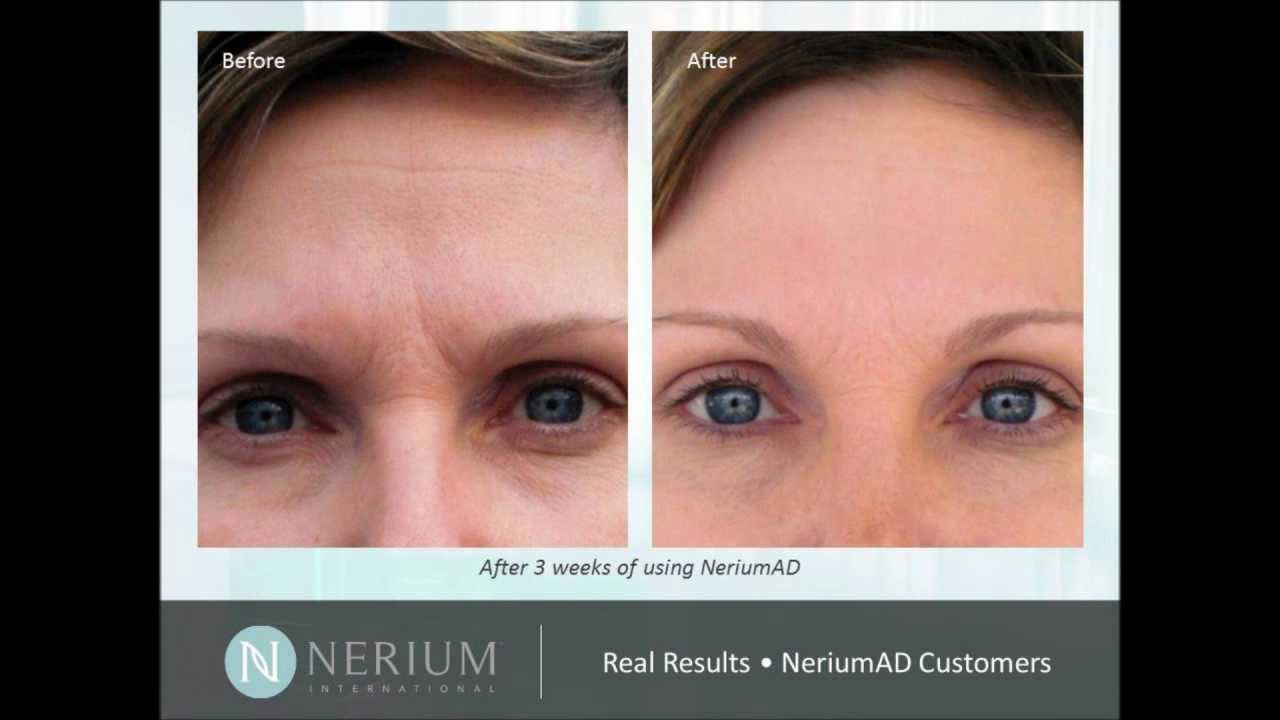 nerium anti aging)