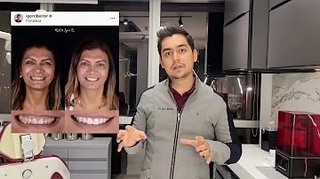 Como aumentar os dentes pequenos?