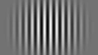 Visual Motion Filtering Test Accurately Predicts Iq