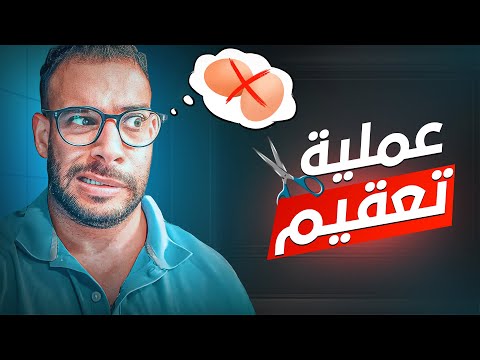 مش حخلف ثاني العملية إلي عملتها