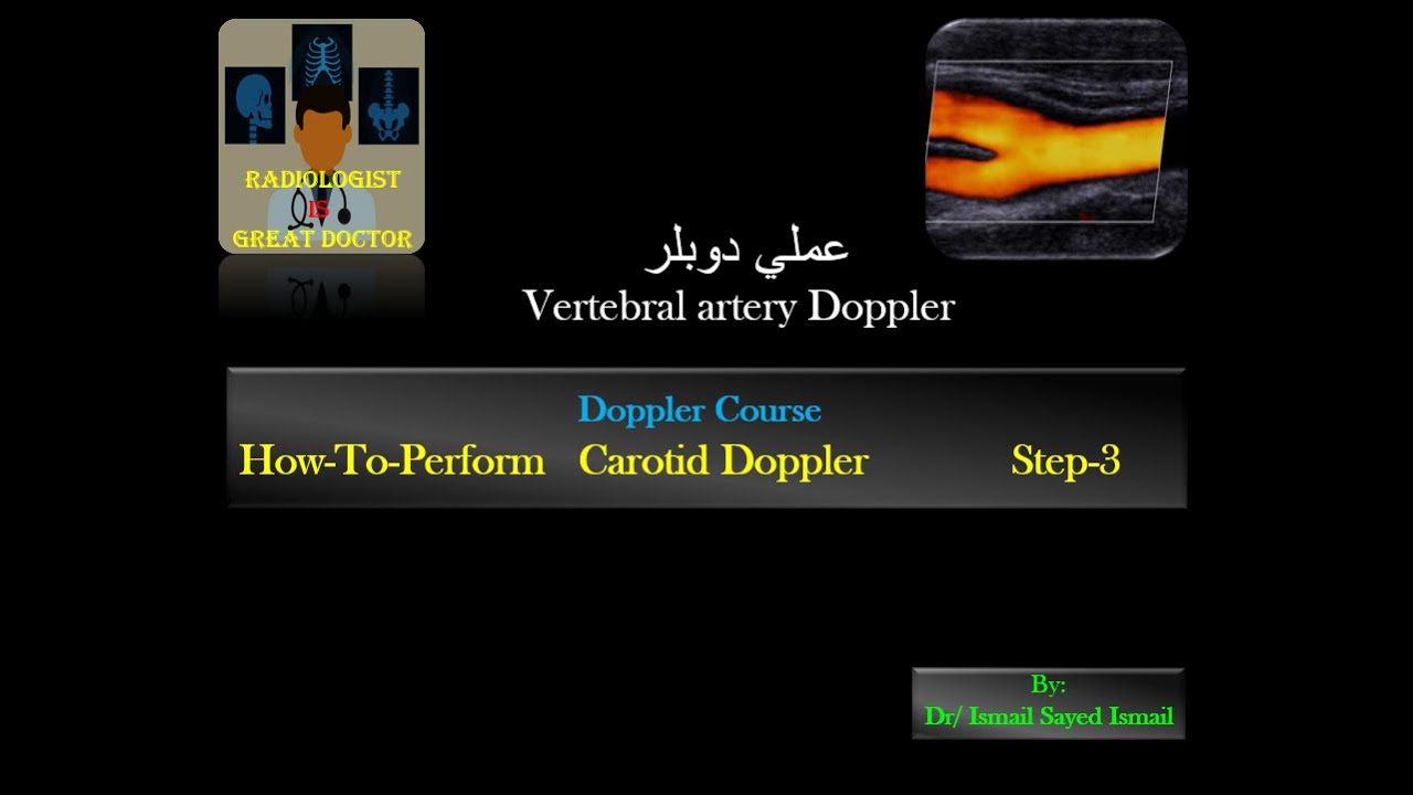 How-To-Perform Carotid Doppler Step-3 (Vertebral artery)