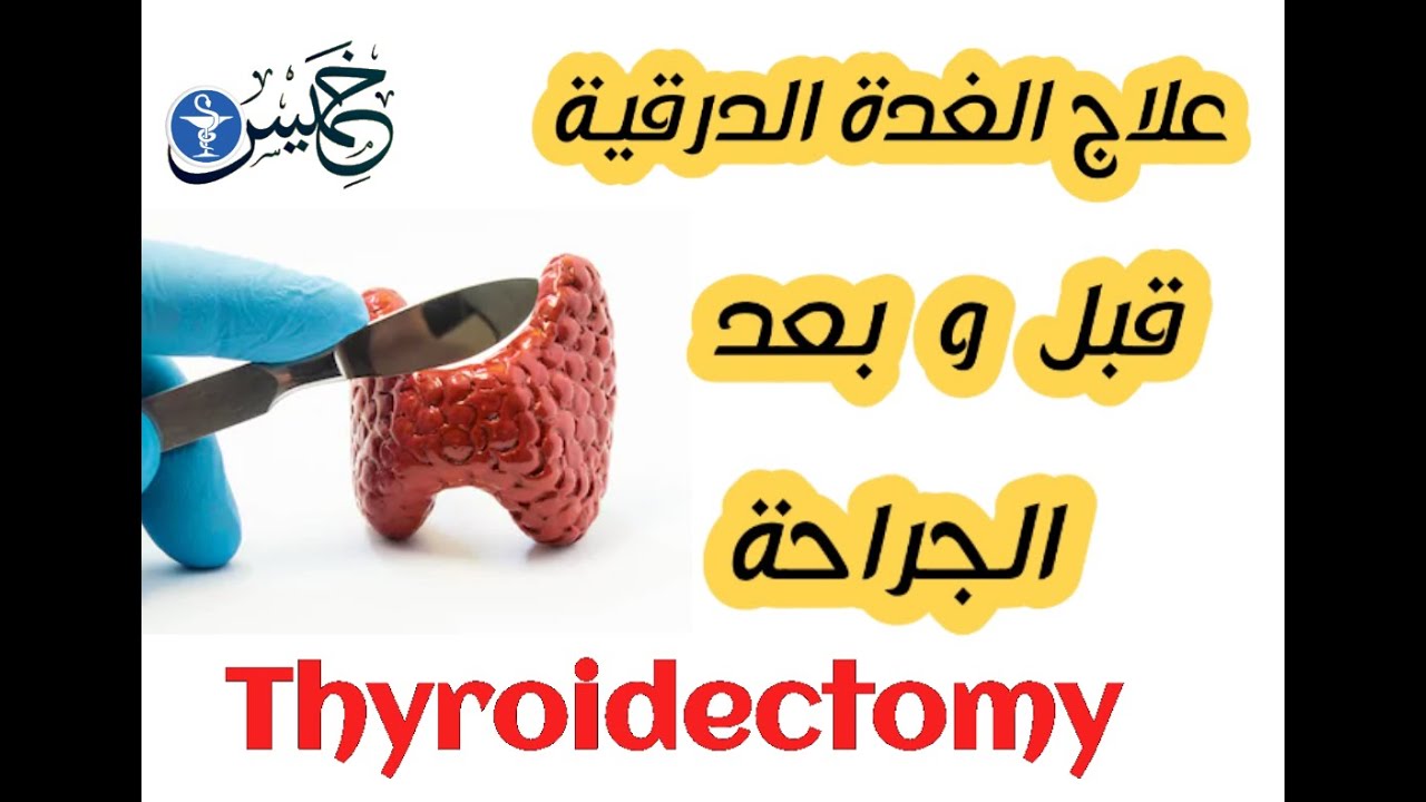 جراحة الغدة الدرقية | استئصال الغدة الدرقية | العلاج قبل وبعد الجراحة | خميس الصيادلة