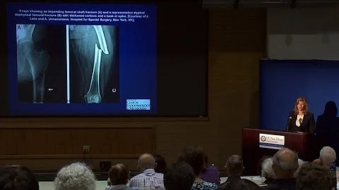 Osteoporosis Update 2013 - Research on Aging - DayDayNews