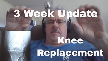 3 Weeks After Total Knee Replacement Surgery Update