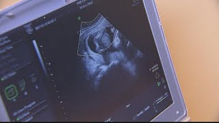 Roe v. Wade | A look at the political impacts if decision is overturned