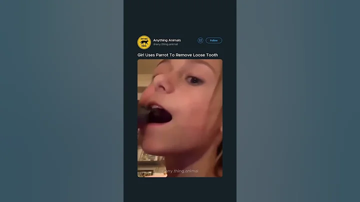 Parrot Helps Girl Pull Tooth 🔽