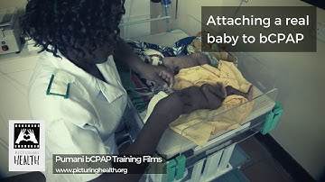Attaching a real baby to CPAP (Pumani bCPAP training films: Section 7 of 13).