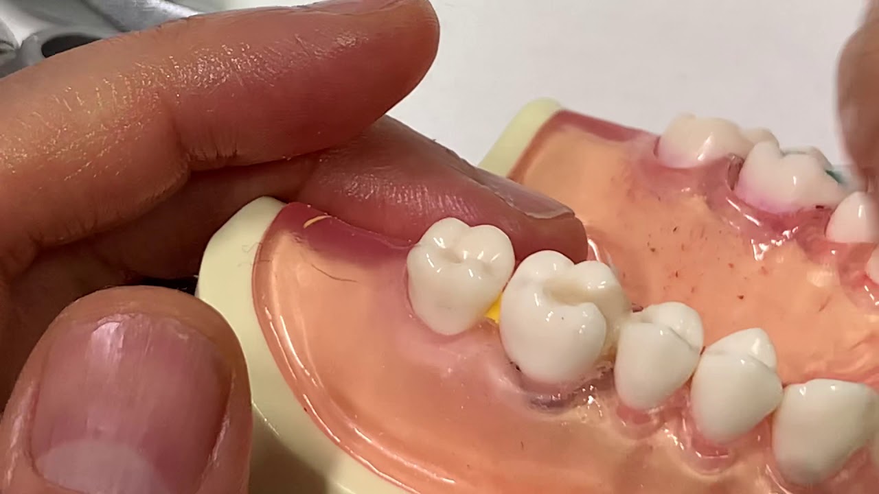 퍼밋 넣는 방법 (2) MO와동