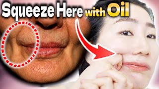 Squeeze & Flatten Here with Oil to Remove Nasolabial Folds and Sagging Around Mouth