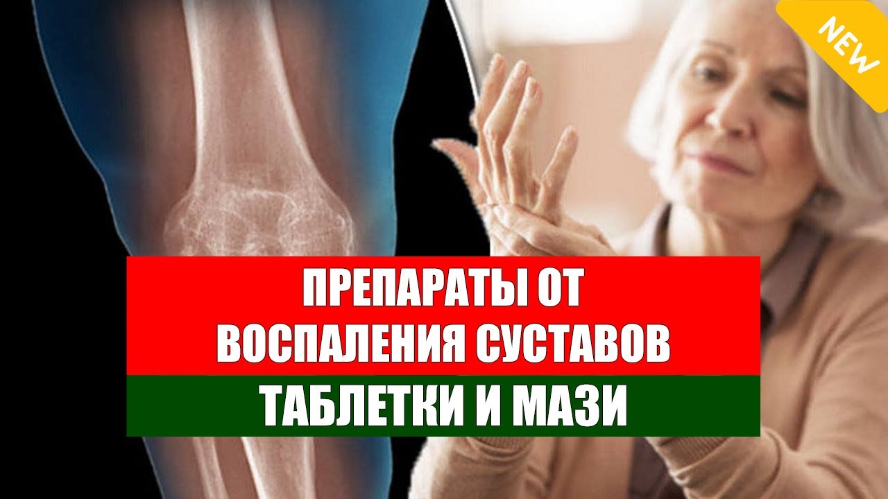 Уколы при артрозе. Лучшие хондропротекторы при артрозе коленного сустава: таблетки, мази. Укол в колено при артрозе ДИПРОСПАН | УКОЛЫ при АРТРОЗЕ и СИНОВИТЕ КОЛЕННОГО СУСТАВА (блокада и внутрисуставной укол)