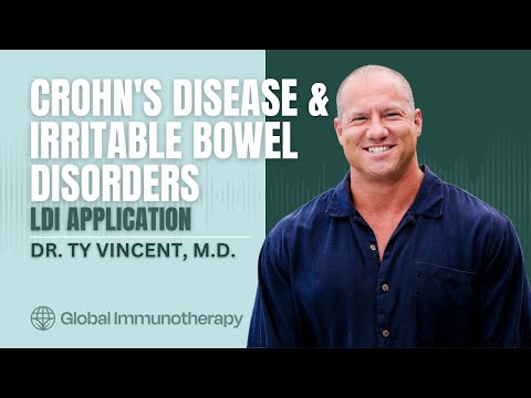 LDI for Crohn's