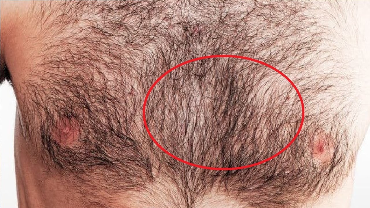 волосатая грудь у беременных (119) фото