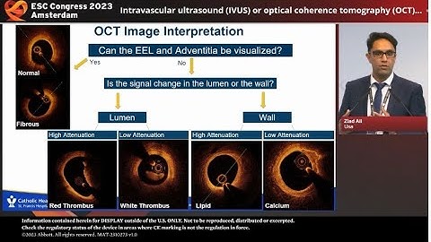 Imaging-Guided (PCI): Evidence Supports A New Standard of Care