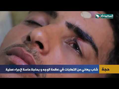 حالة إنسانية بحاجة للمساعدة