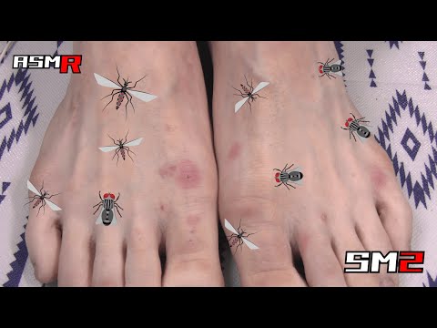 【虫刺され＋アトピー性皮膚炎＝想像を絶する痒み】蚊と虻に刺されまくって超痒い足を一心不乱に掻く音/癒し/リラックス効果/睡眠導入/マッサージ