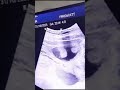 We Couldn T Wait To Know If You Re A Boy Or Girl Genderreveal 