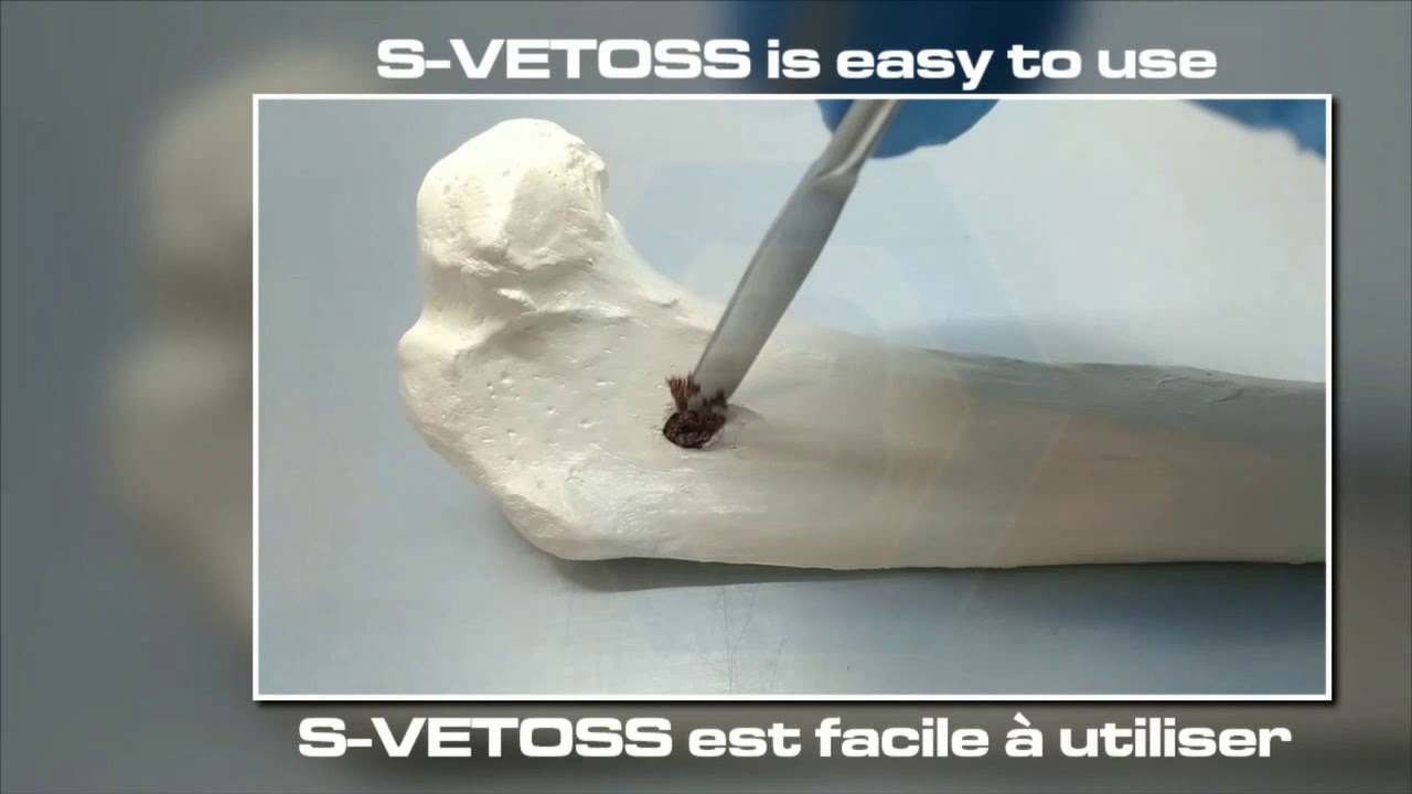 SVETOSS Orthopedic Bone Graft YouTube