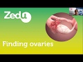 How to: Ovarian Ultrasound - Location, Torsion + Spectral Doppler - Zedu Coaching Corner 28 May 2020