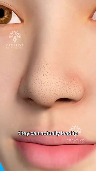 Why Pore Strips Can Actually Cause MORE Blackheads #short #viralvideo - Creativelearning3d