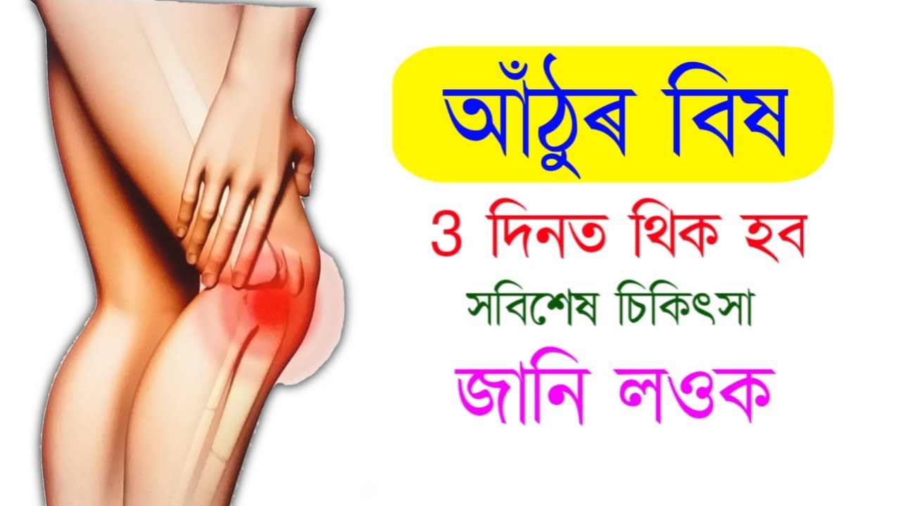 Knee Pain Treatment at Home | Home Remedies For Knee Pain - YouTube
