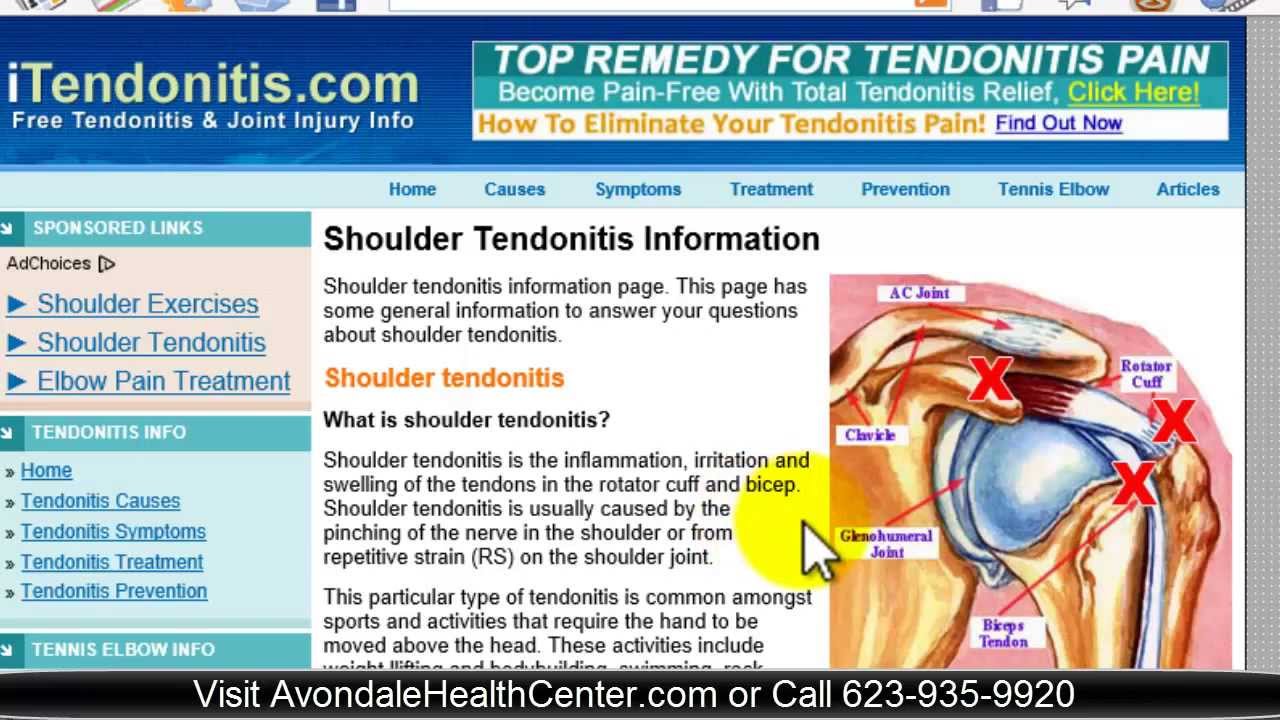 How to treat tendonitis in the shoulder