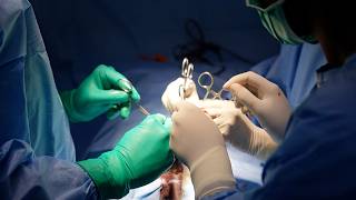 26-Year-Old Male | ZSR 2.0 Stapler Circumcision | Complete Procedure
