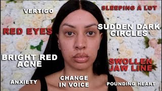 UPDATE & FIRST SIGNS OF IMPLANT ILLNESS DOCUMENTARY PART 2