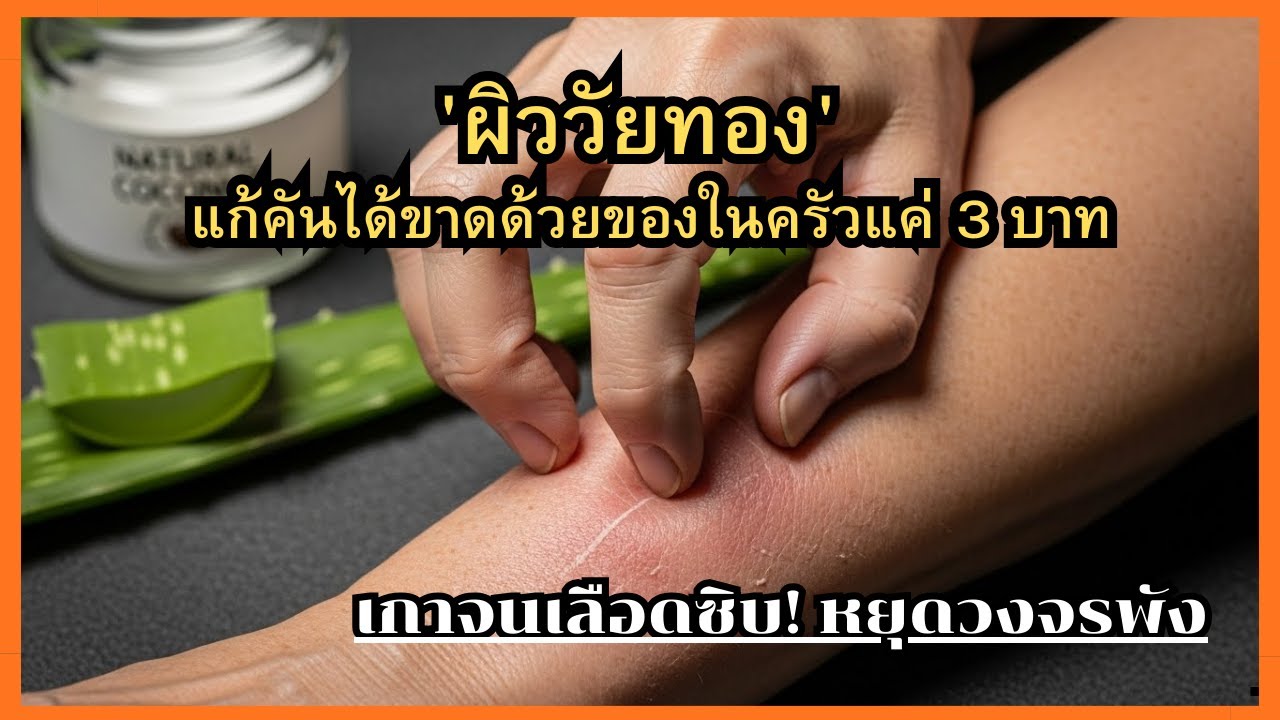 ผิววัยทองเกาเลือดซิบ! หยุดทรมานด้วยวิธี 3 บาท ไม่ต้องหาหมอ