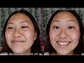 GOATED Skincare Routine!! A Hot Girl Summer guide to CLEAR and GLOWY Skin ;)