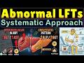 Abnormal Liver Function Tests (LFTs) | How to Interpret Abnormal Liver Function Tests with Examples