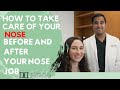 POST-OP INSTRUCTIONS - PRE-OP INSTRUCTIONS  - Scarless Nose - Closed Rhinoplasty - Dr. Deepak Dugar