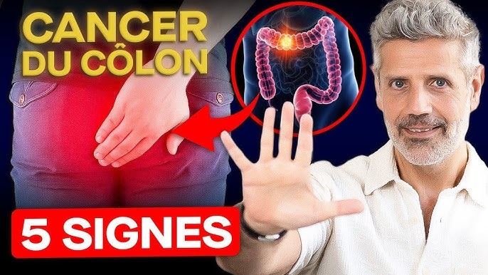 Gastroentérologie: dépistage du cancer colorectal par coloscopie ...