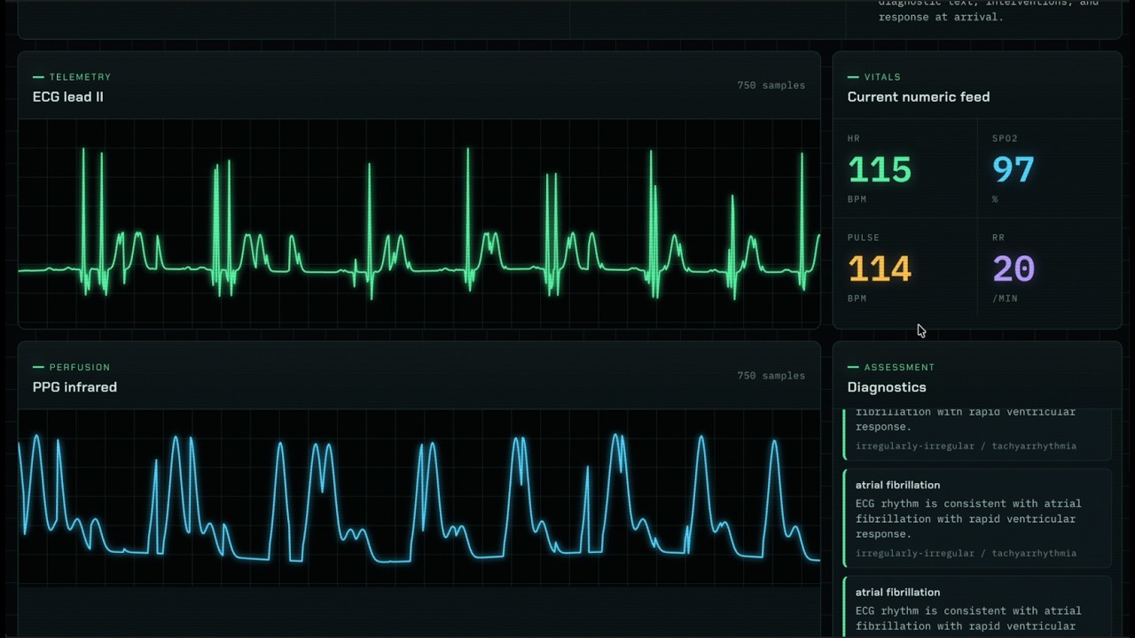 Realtime patient assessment for medical emergencies (ambulance, ER), with corti.ai [DEMO]