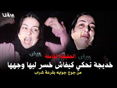 خديجة تحكي كيفاش خسر ليها وجهها من جوج جوايه بقرعة شراب قاليا علاش نتي زوينة وف جر ليا وجهي