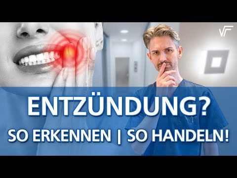 Video: Aus Welchem Grund Kann Die Wange Weh Tun?