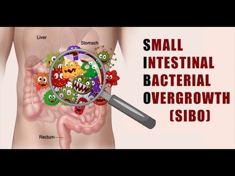 SIBO / kontaminált vékonybél szindróma