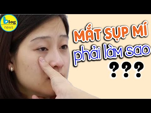 Video: Sụp Mí Mắt Dưới ở Chó