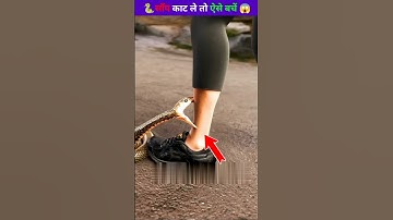 If a Snake Bites You by Mistake… Do THIS Fast! 😱