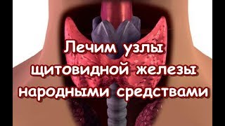 Лечим узлы щитовидной железы - народными средствами Лечим узлы щитовидной железы - народными средствами