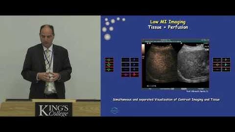 Introduction to Contrast Enhanced Ultrasound   Technical and Clinical Basics