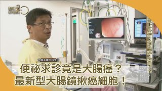 大腸癌現形最新型大腸鏡揪癌細胞　不用煎熬等結果【聚焦2.0】第393集