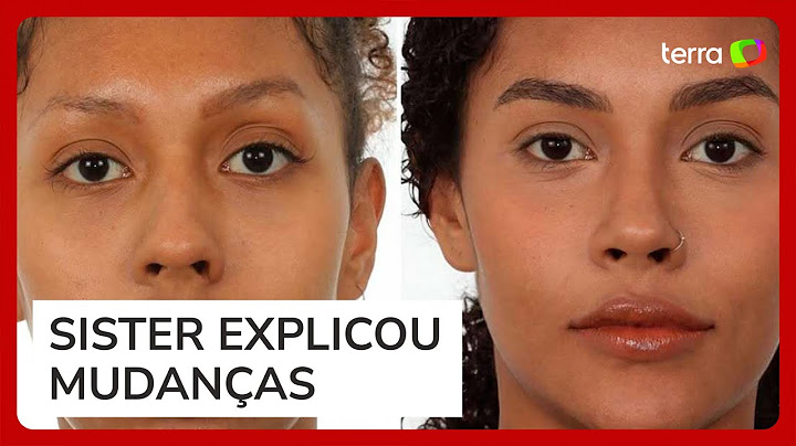 BBB25: Giovanna, irmã de Gracyanne, revela cirurgia no rosto e resultados impressionantes