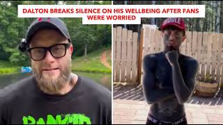 Dalton Breaks Silence On His Wellbeing After Fans Were Worried