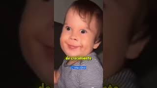 Historia Del Cerebrito