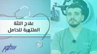 علاج اللثة الملتهبة للحامل