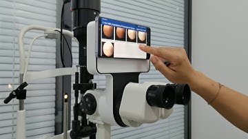 Phonto slit lamp digital imaging module support for Android phone& iPhone