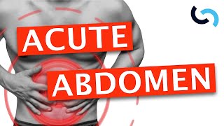 Acute Abdomen  Diagnosis and Management