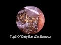 Top3 Of Dirty Ear Wax Removal With Relaxing Music and Flower Background