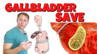 How to Save a Gallbladder and Get Rid of Gallstones